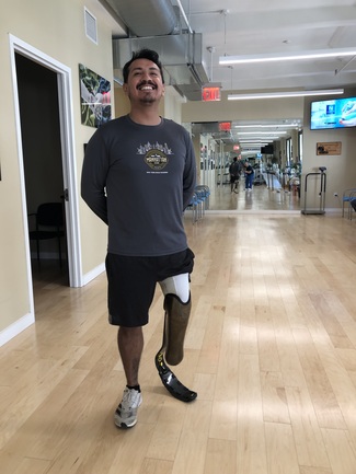 custom below the knee prosthetic leg with running blade